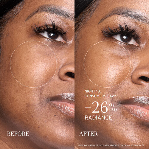 Lotus AHA Gentle Resurfacing Serum