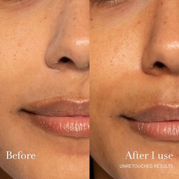 Rose & Hyaluronic Acid Deep Hydration Moisturizer-Proven results-Image