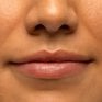 sugar lip treatment