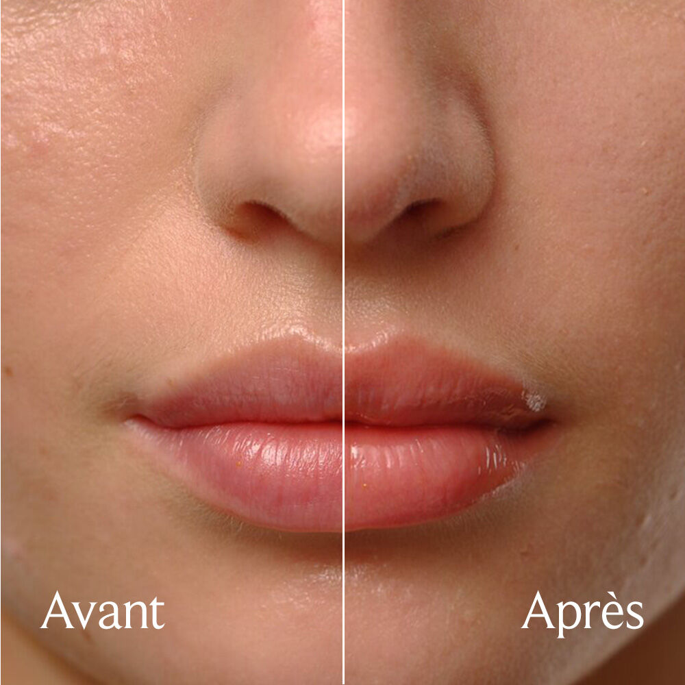 Huile pour les l&egrave;vres Sugar Treat