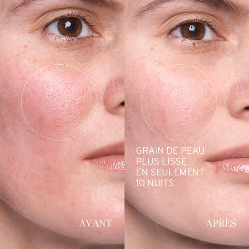 Sérum Lotus AHA Gentle Resurfacing